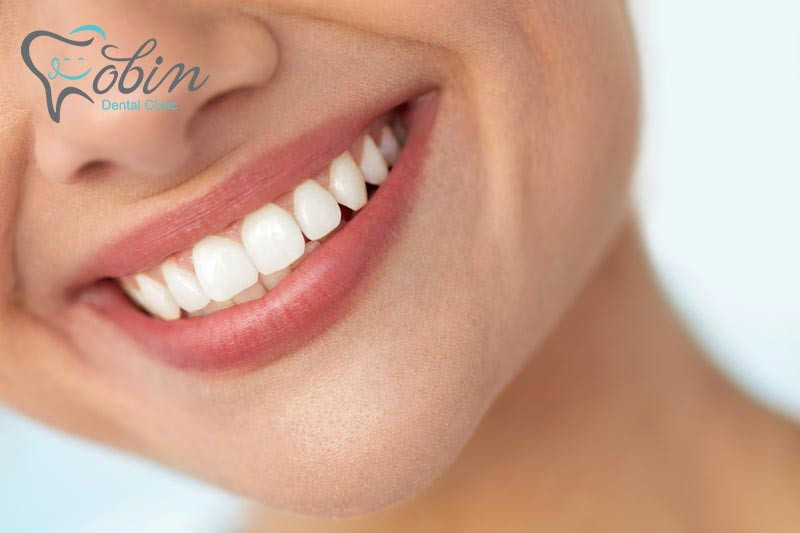 آسیب های دندان به وسیله کامپوزیت برطرف می شود
